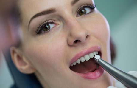 Smile Designers | Whitening bleaching services